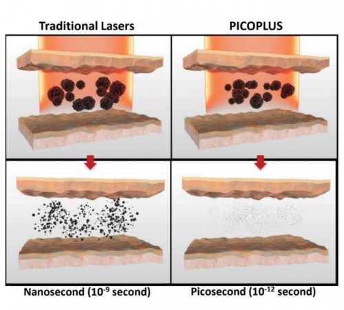4การทำงานของpico