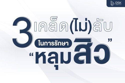 3 เคล็ด (ไม่) ลับในการรักษาหลุมสิว