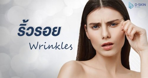 โบทอกซ์ ฟิลเลอร์ ริ้วรอย