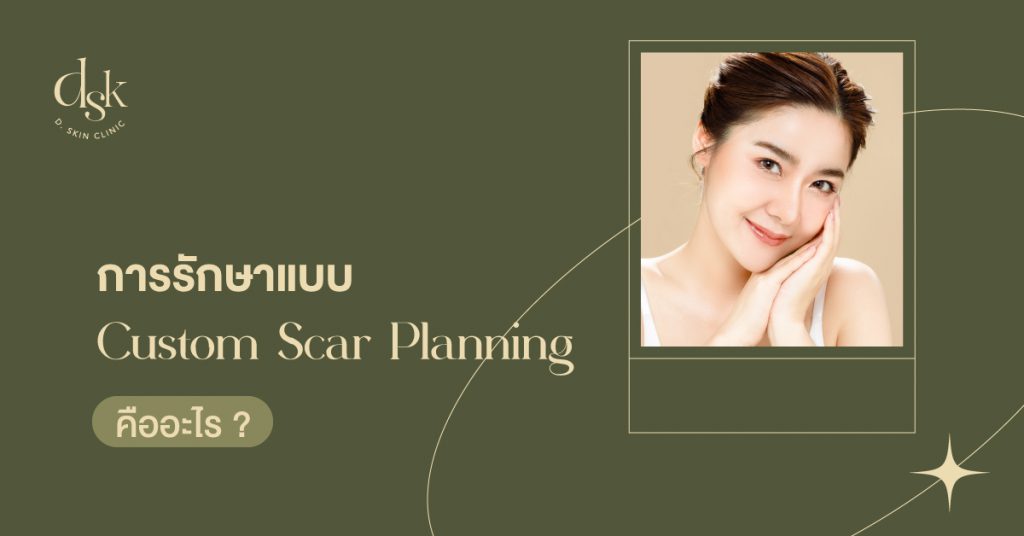 การรักษาแบบ Custom Scar Planning คืออะไร