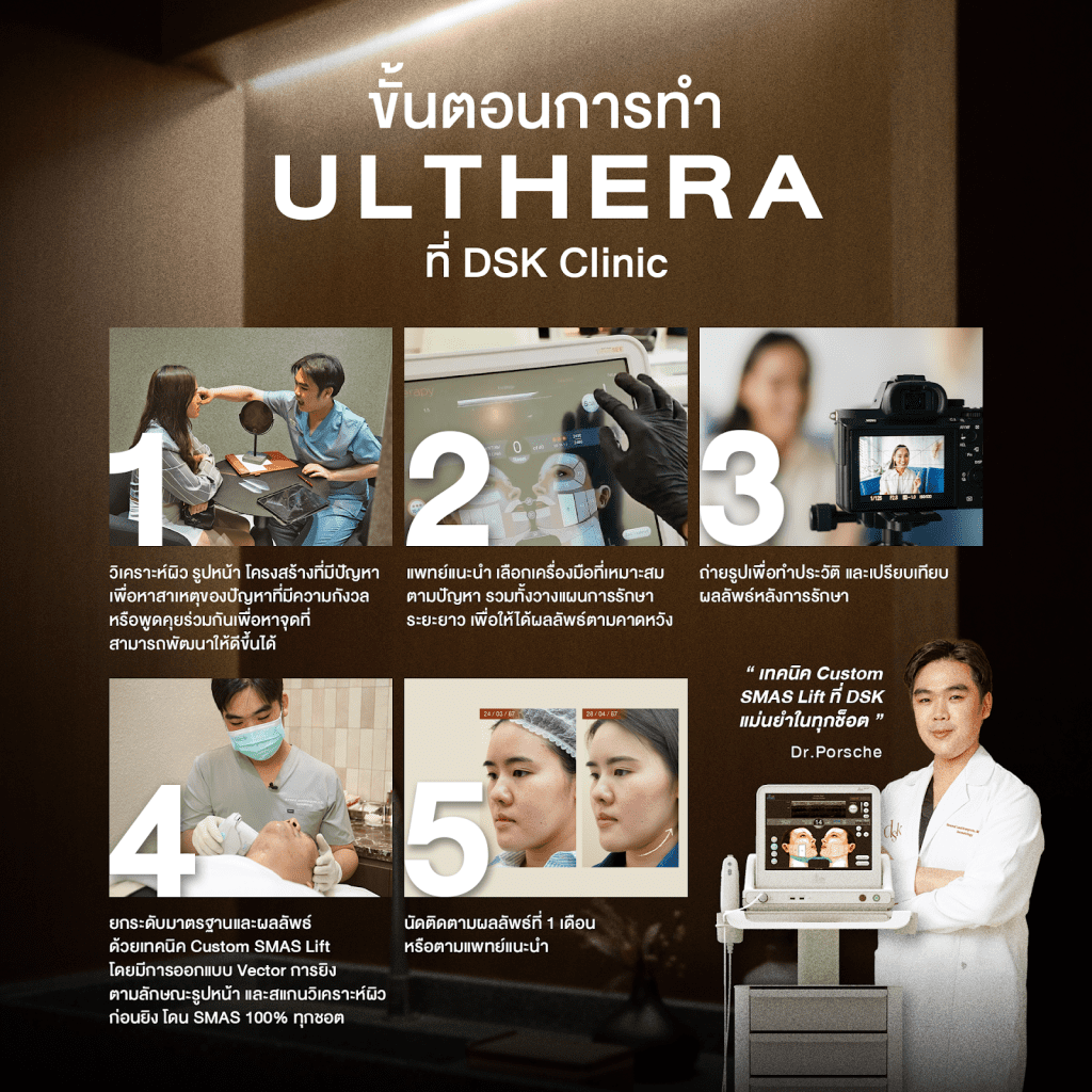 ulthera