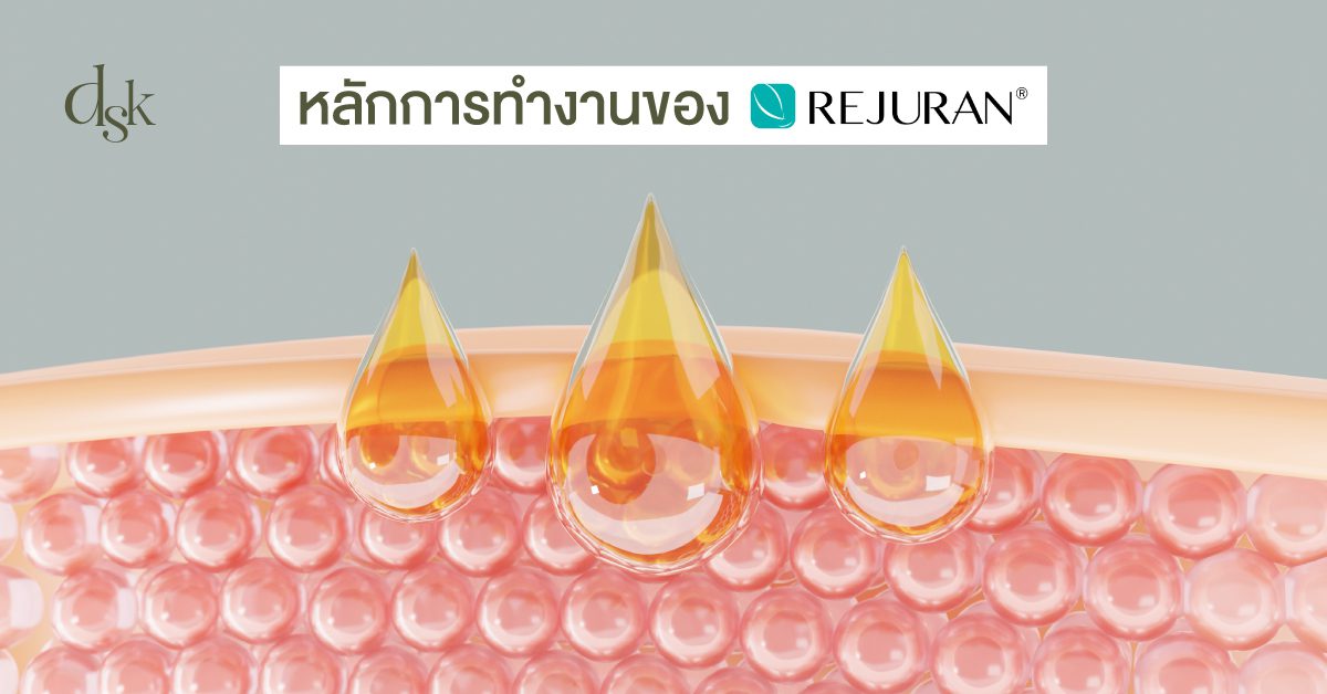 หลักการทำงานของ Rejuran