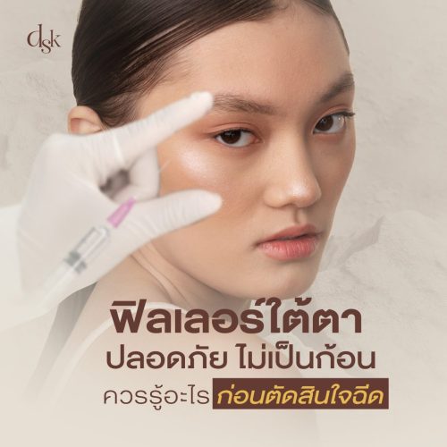 ฟิลเลอร์ใต้ตา แก้ปัญหาตาคล้ำ เติมร่องใต้ตา ช่วยให้ใบหน้าอ่อนเยาว์