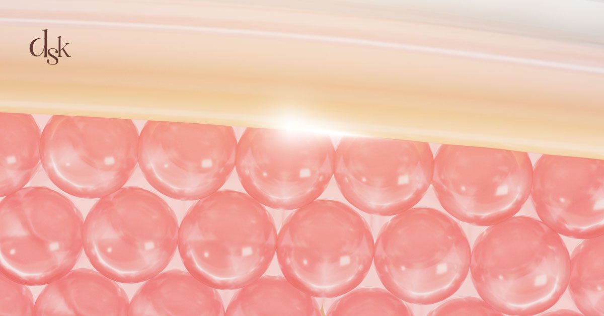 จุดที่เหมือนกันระหว่าง Sculptra VS. Radiesse