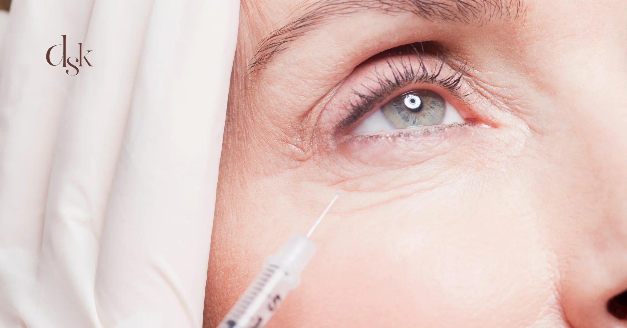 ฟิลเลอร์ใต้ตาอยู่ได้นานไหม