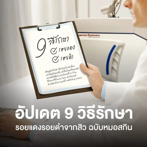 อัปเดต 9 วิธีรักษารอยแดงจากสิว รอยดำจากสิว ฉบับหมอสกิน