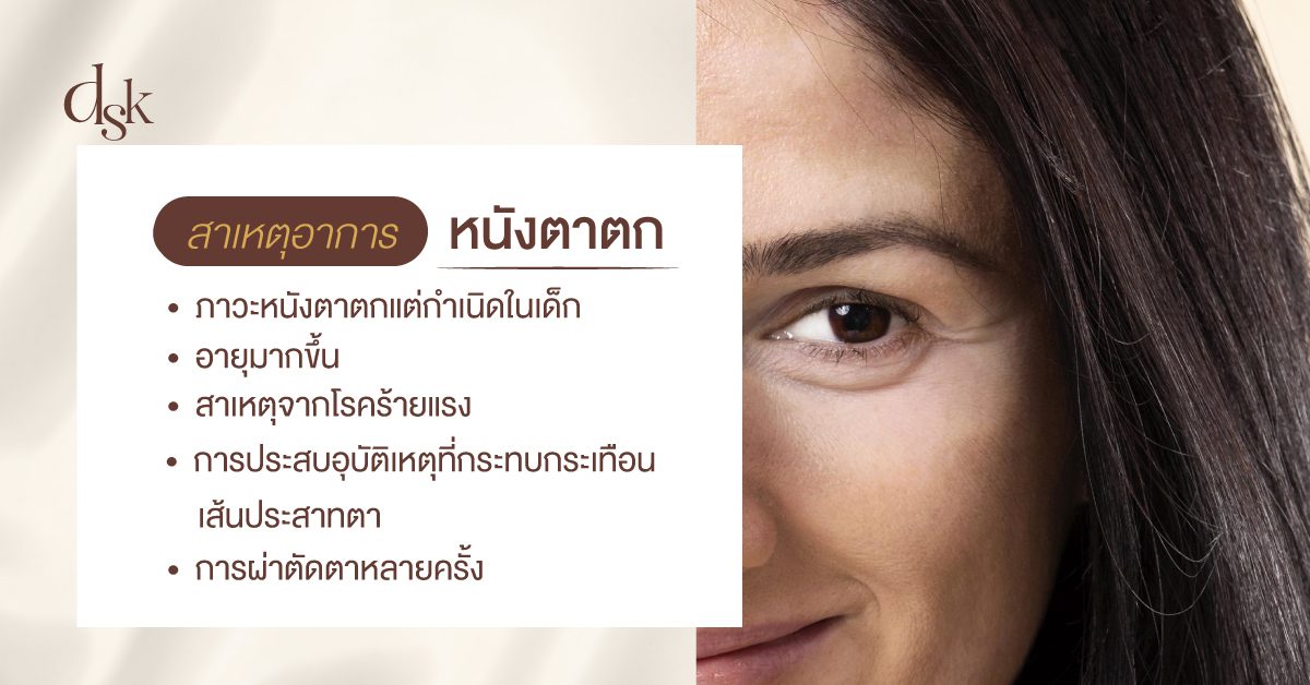 สาเหตุอาการหนังตาตก