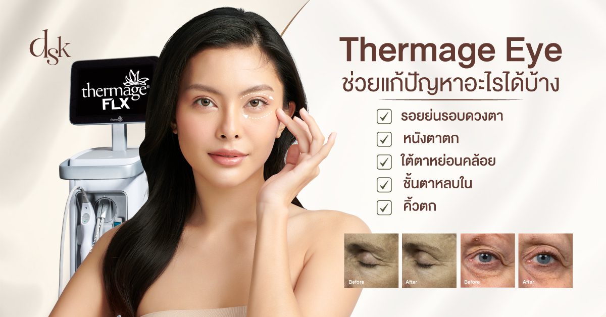 Thermage Eye ช่วยแก้ปัญหาอะไรได้บ้าง