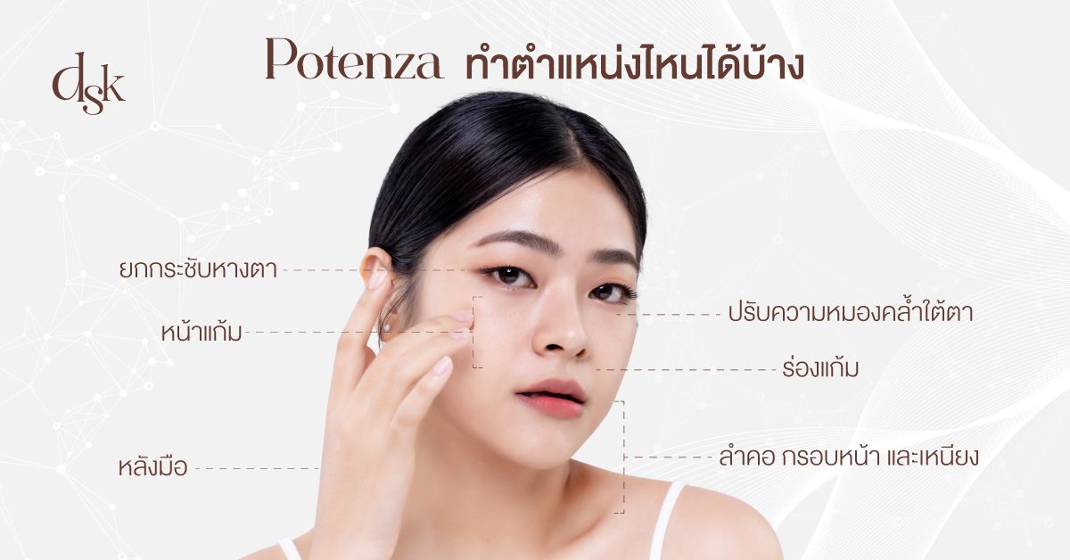 Potenza ทำตำแหน่งไหนได้บ้าง