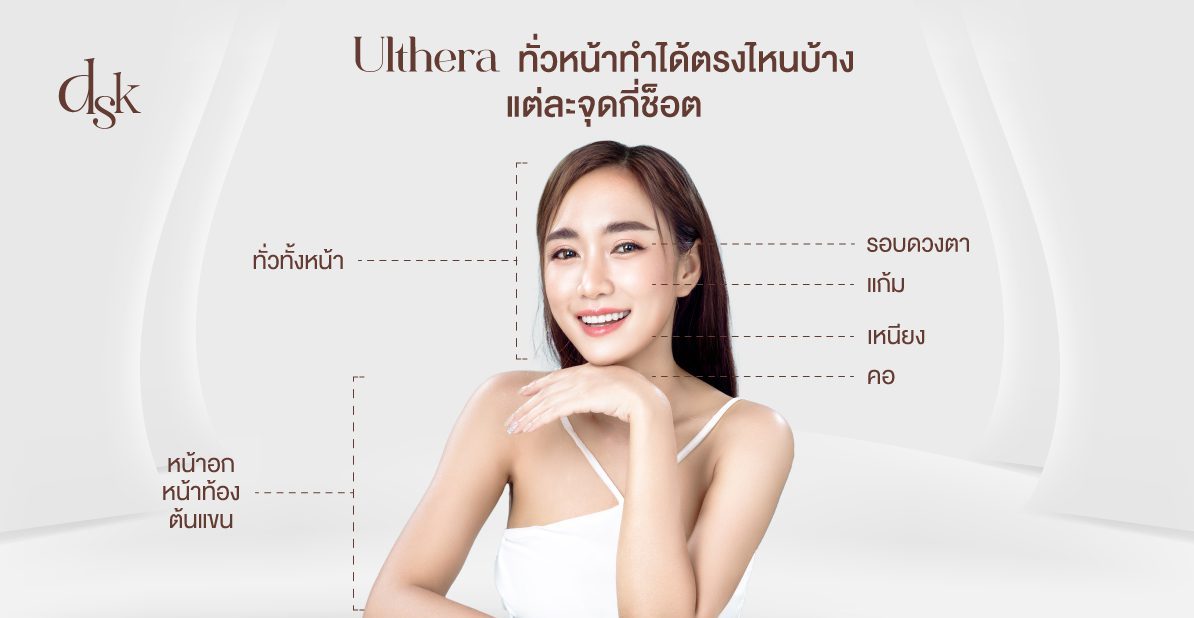Ulthera ทั่วหน้าทำได้ตรงไหนบ้าง แต่ละจุดกี่ช็อต