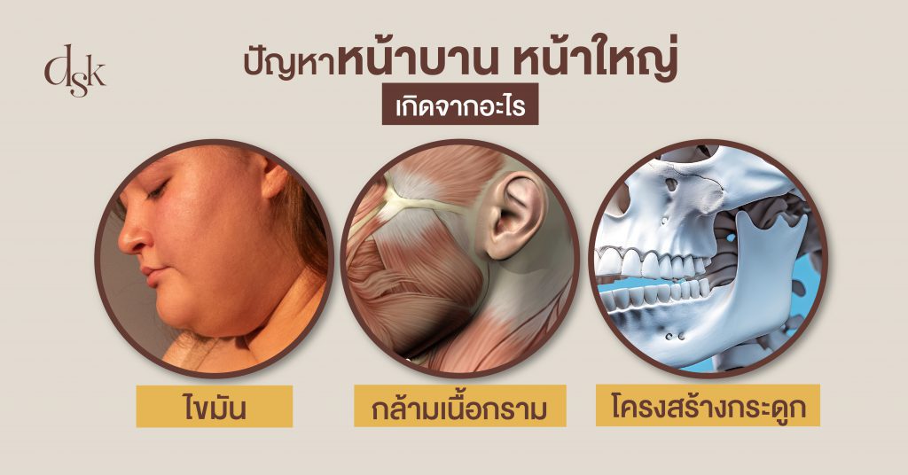 ปัญหาหน้าบาน หน้าใหญ่ เกิดจากอะไร