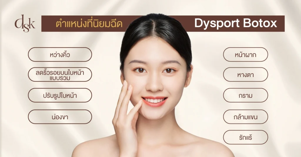 ตำแหน่งที่นิยมฉีด Dysport Botox