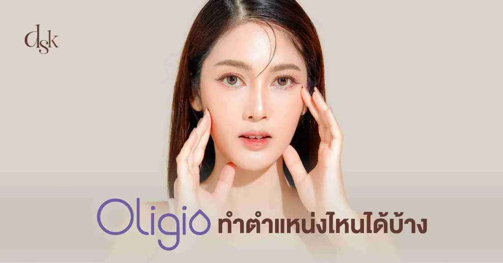 Oligio ทำตำแหน่งไหนได้บ้าง