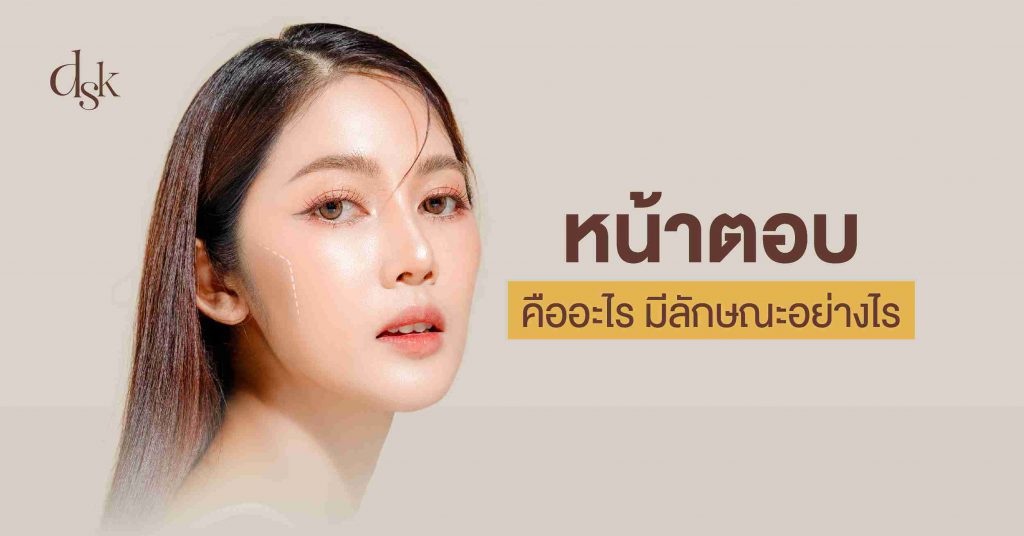 หน้าตอบ คืออะไร มีลักษณะอย่างไร