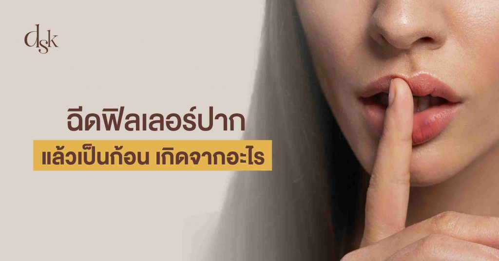 ฉีดฟิลเลอร์ปากแล้วเป็นก้อน เกิดจากอะไร