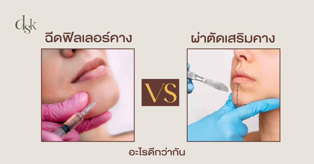 ฉีดฟิลเลอร์คาง VS ผ่าตัดเสริมคาง อะไรดีกว่ากัน