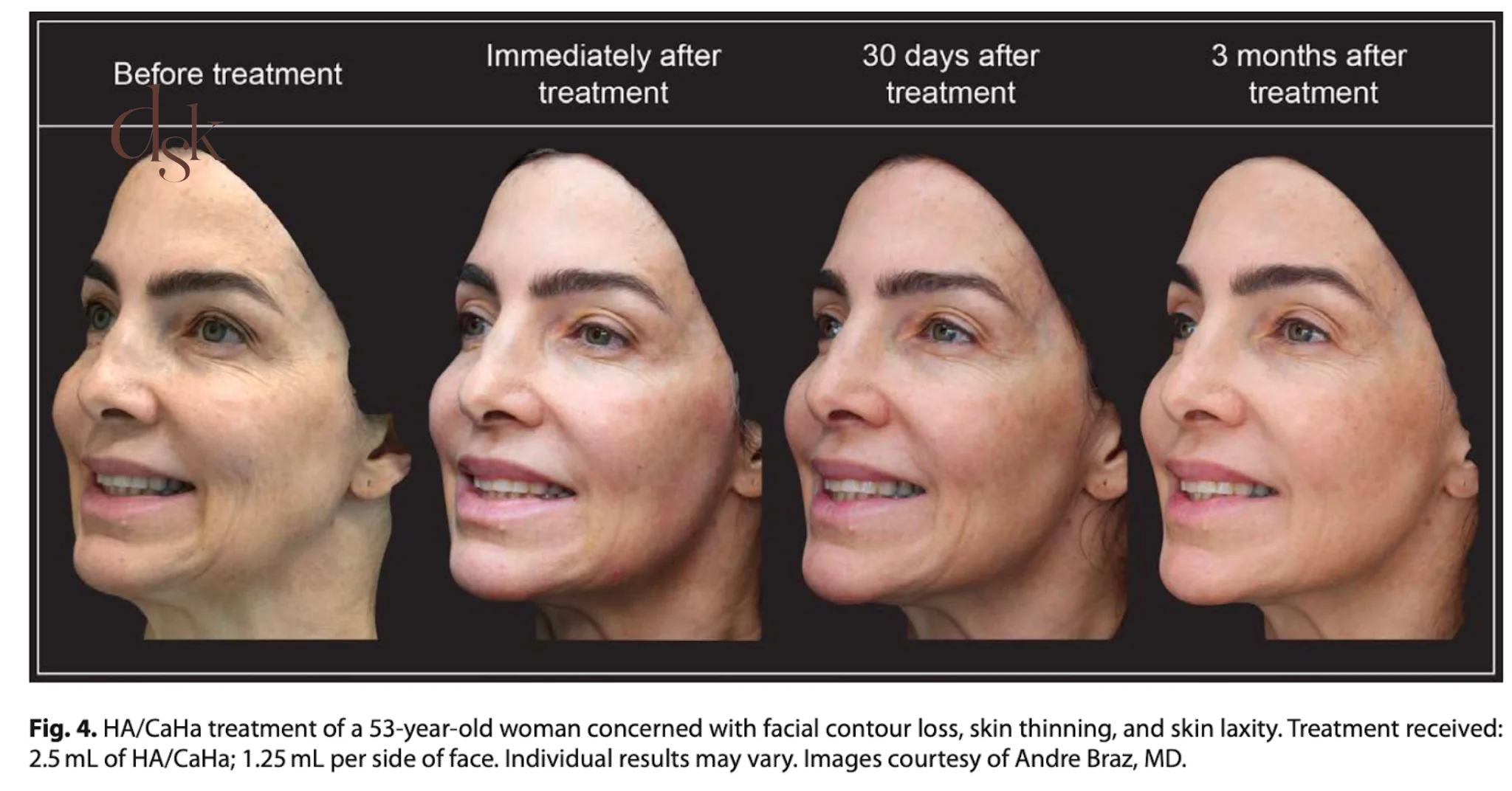 HArmonyCa ดีไหม)