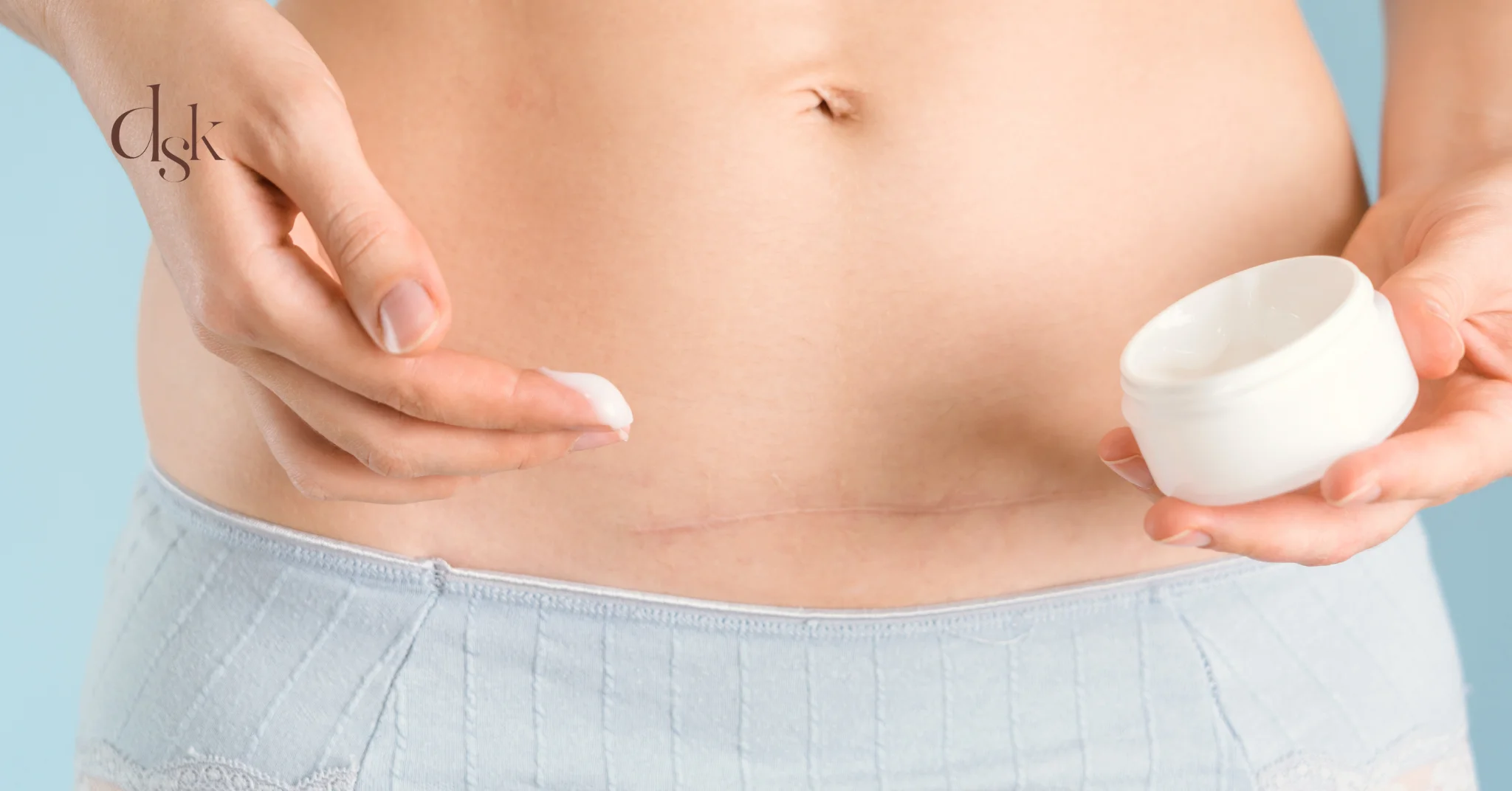 แผลผ่าตัด