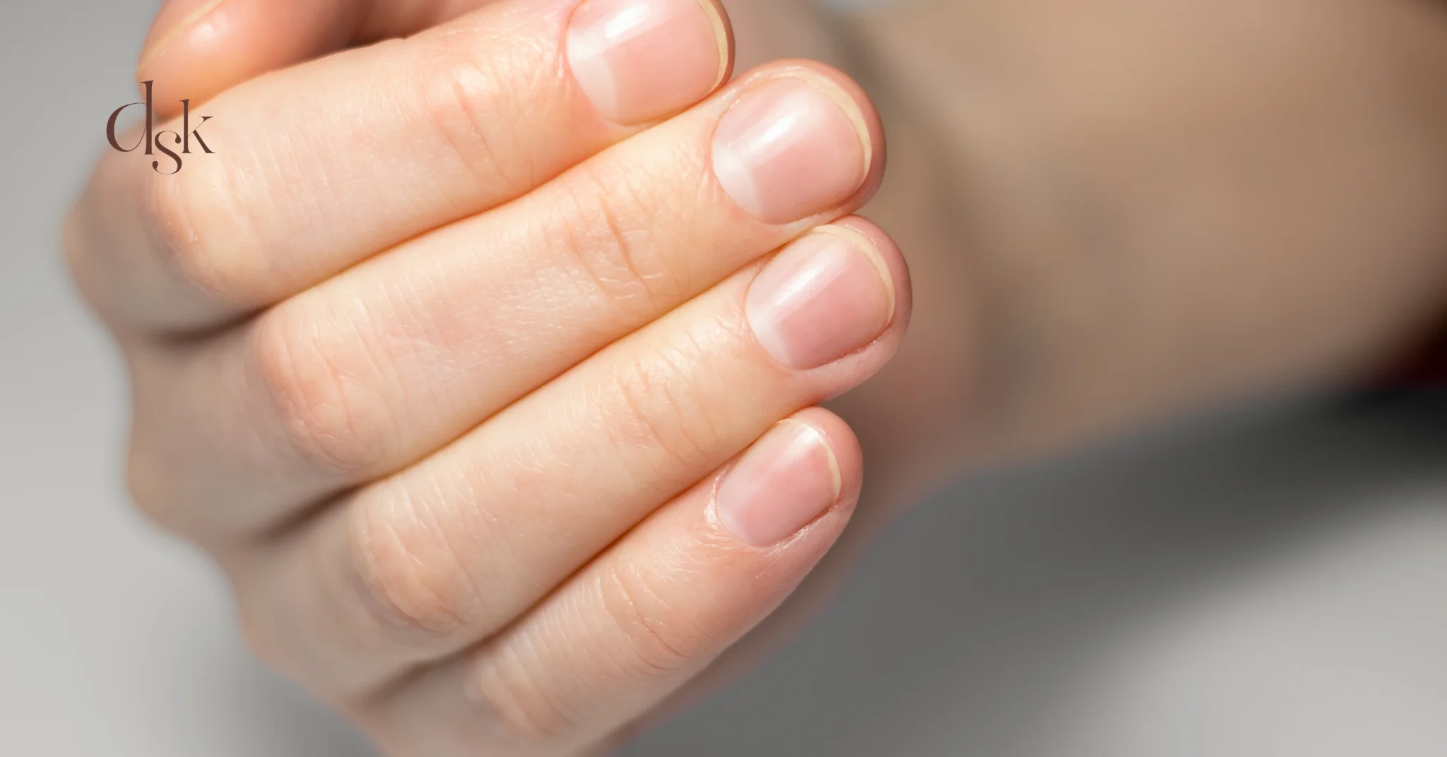 3 คอลลาเจนกับเส้นผมและเล็บ