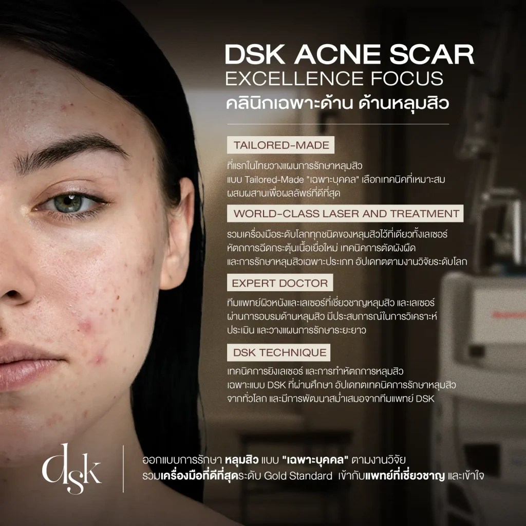 Acne Scar Excellence Focus 2025