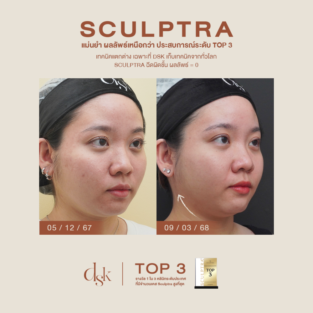 HN.B67-001574_Sculptra_dr.gift