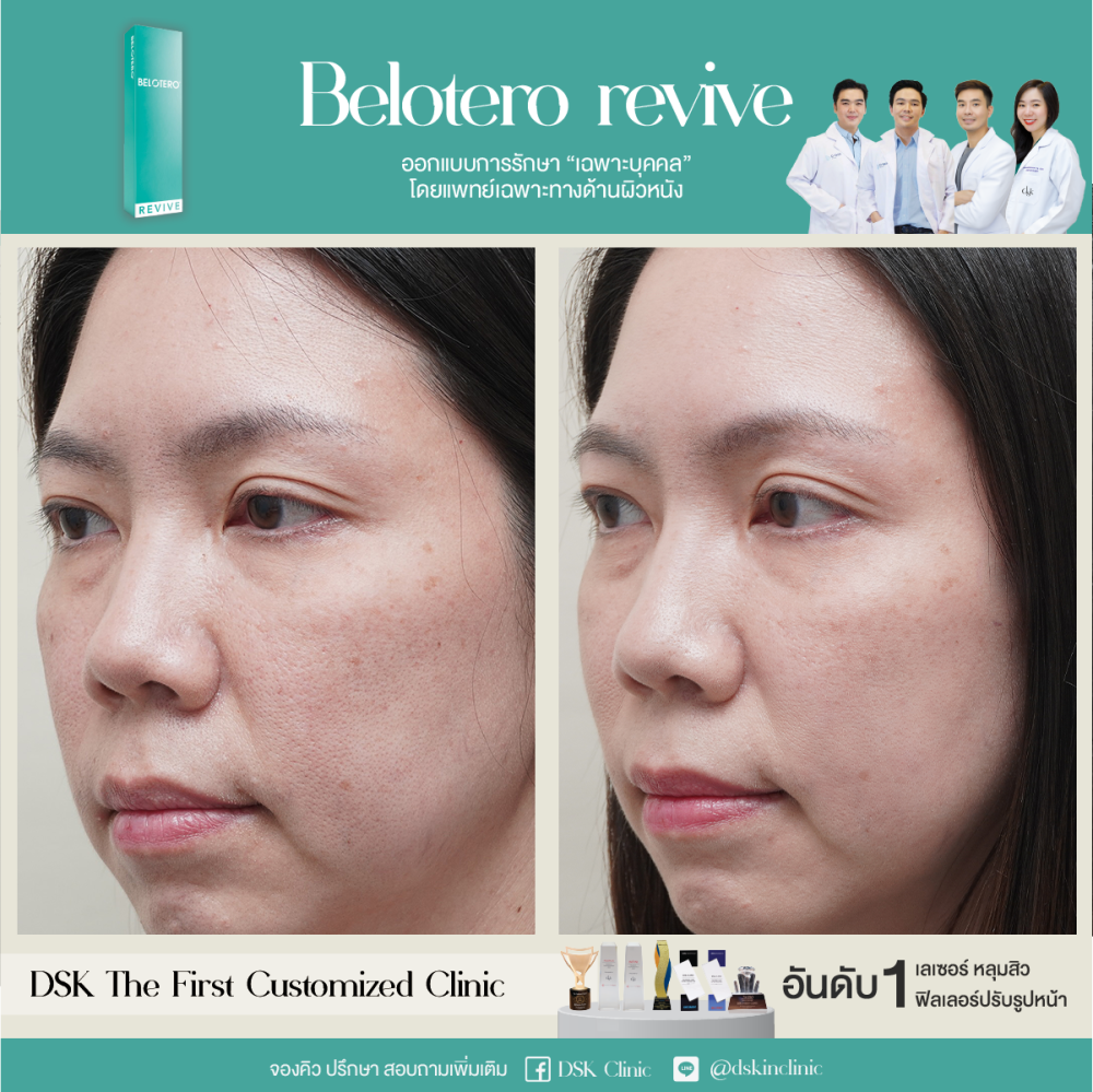 HN.R66-017738_revive