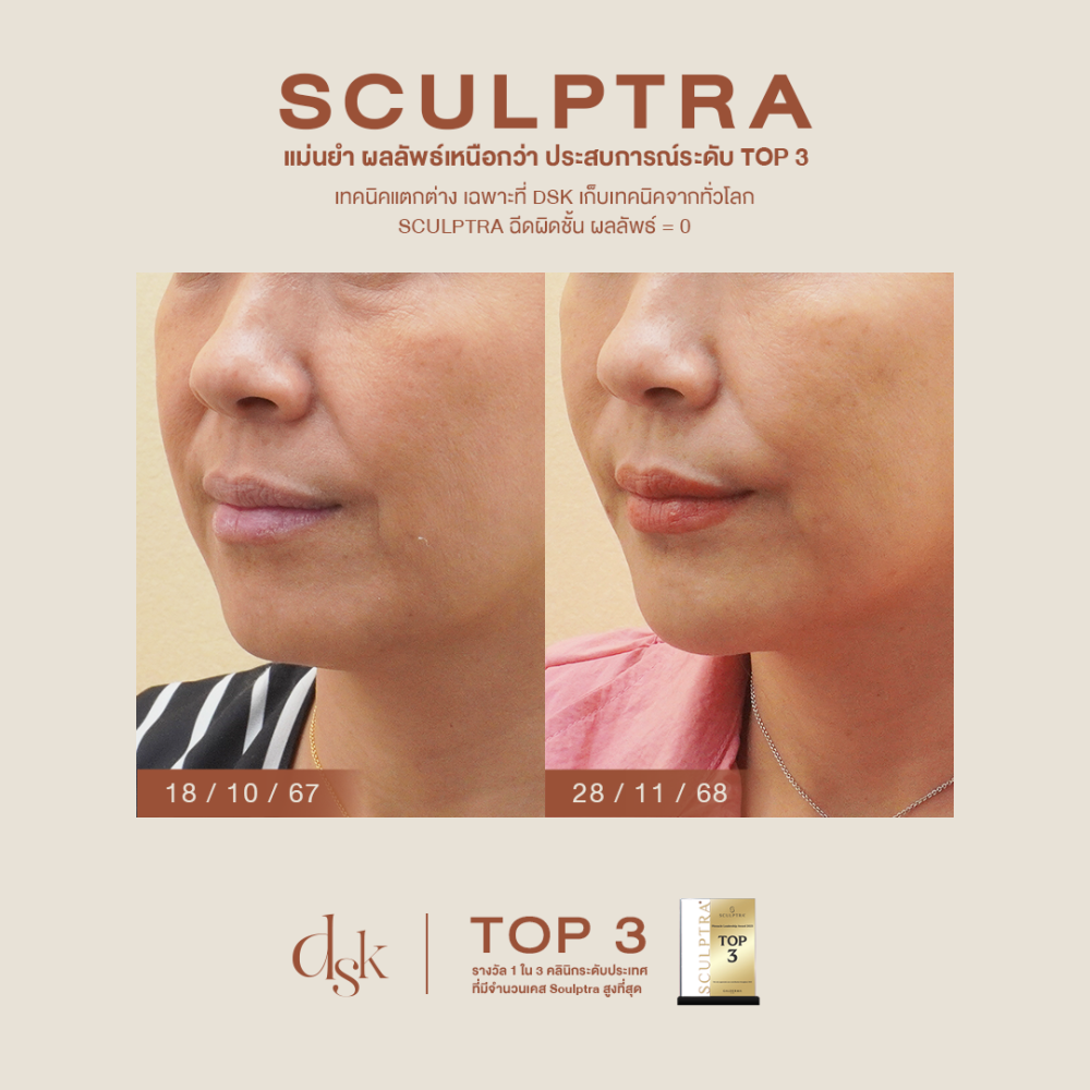 HN.S67-002298_sculptra_drboong
