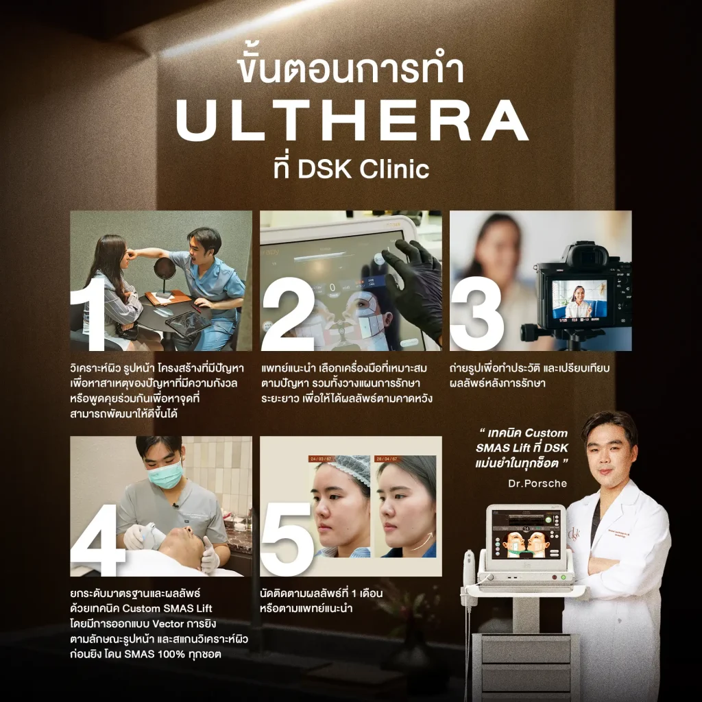 Ulthera