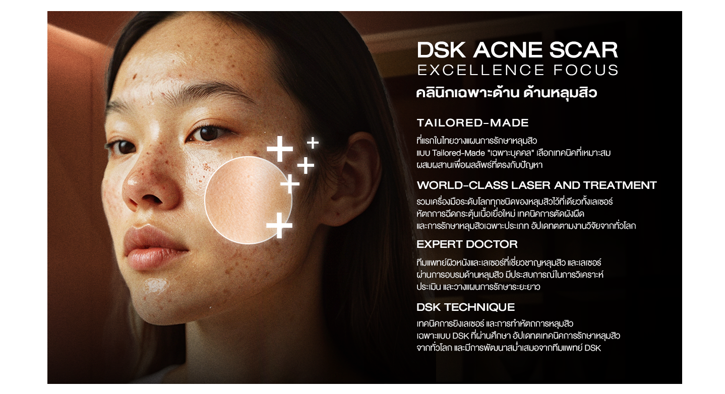 ทำไมต้อง acne