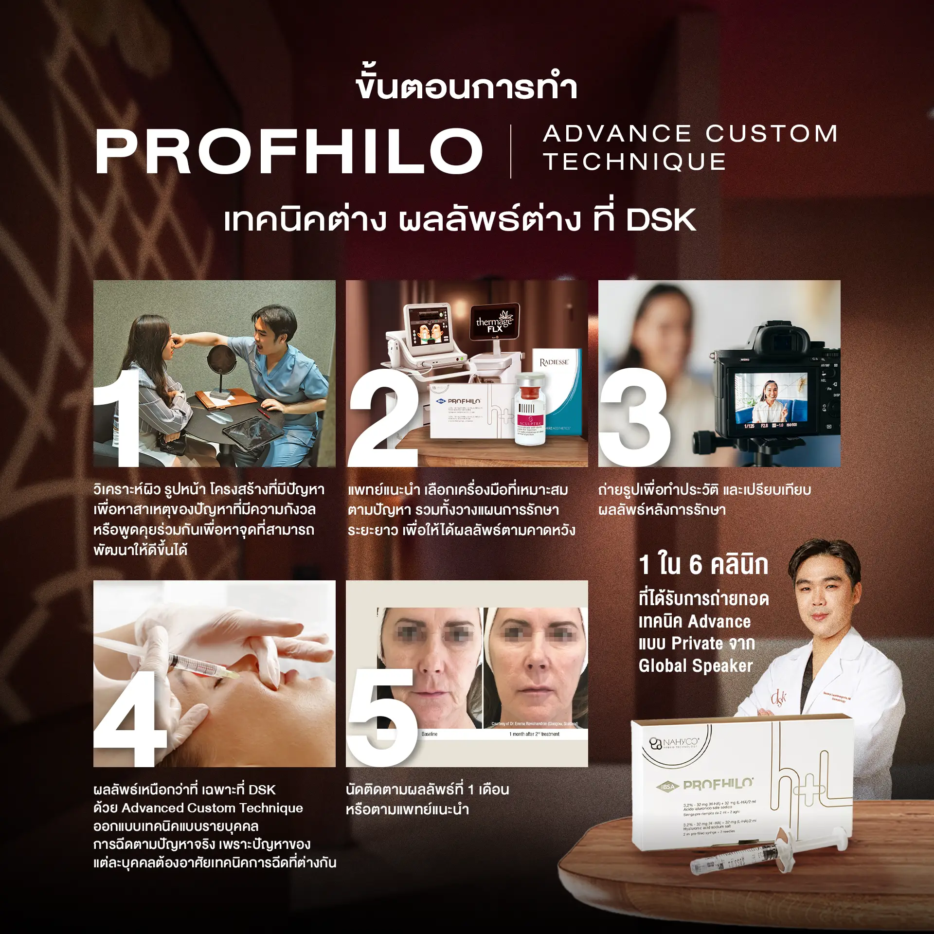 Profhilo [Step]