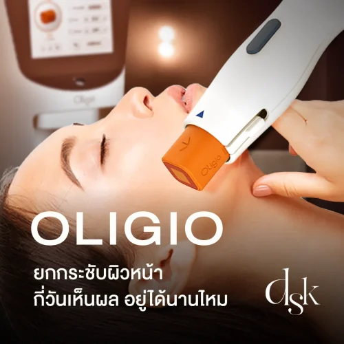 ยกกระชับผิวหน้า Oligio ราคาเท่าไหร่ กี่วันเห็นผล อยู่ได้นานไหม ทำคลินิกไหนดี?