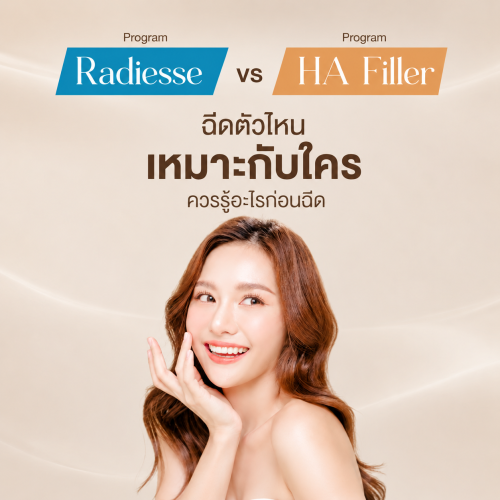 Radiesse VS HA Filler ฉีดตัวไหน ราคาเท่าไหร่ เหมาะกับใคร ควรรู้อะไรก่อนฉีด