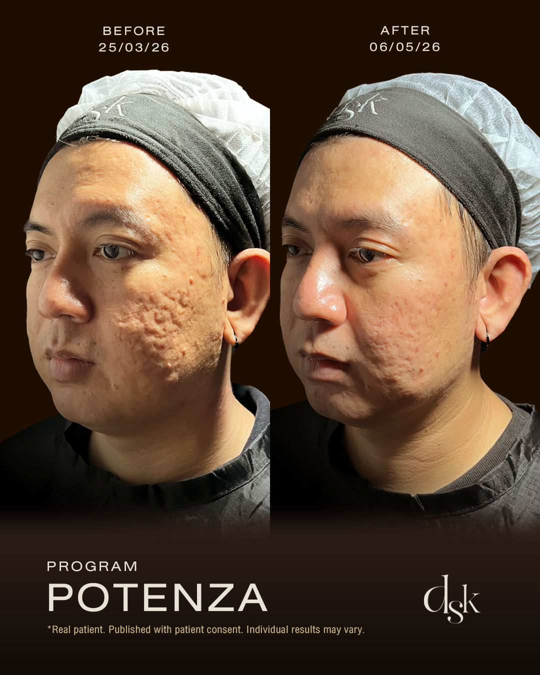 Potenza รีวิว