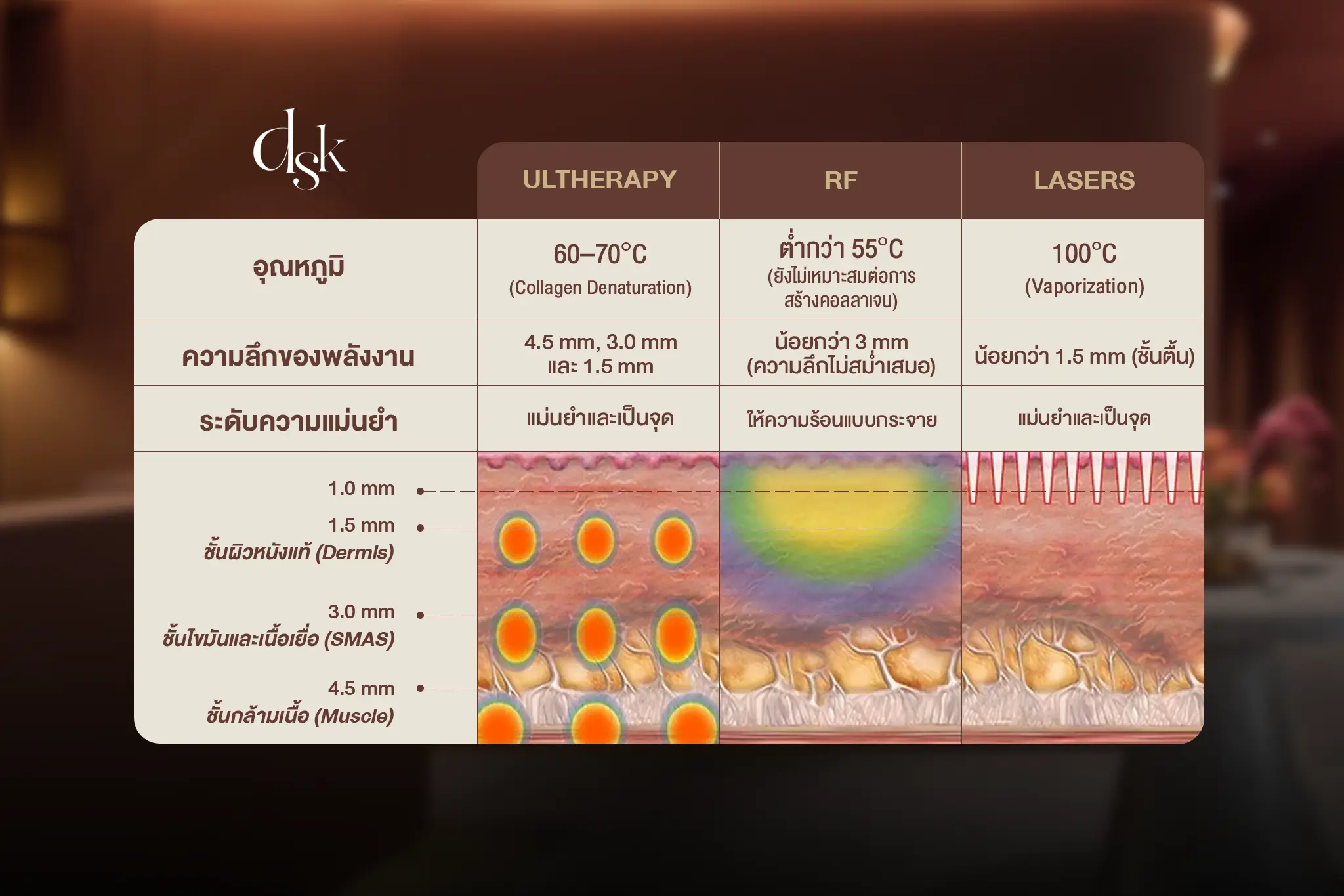 ระดับความลึกของหัว Ulthera