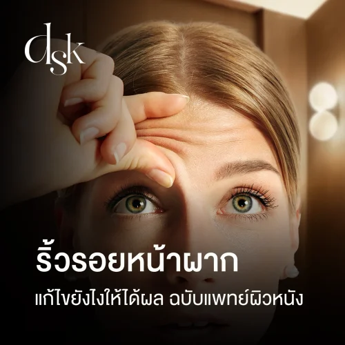ริ้วรอยหน้าผากแก้ยังไง? รวมวิธีลดริ้วรอยหน้าผากย่นให้ได้ผล ฉบับแพทย์ผิวหนัง