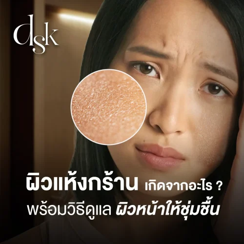 ผิวแห้งกร้านเกิดจากสาเหตุใด พร้อมวิธีดูแลผิวหน้าให้ชุ่มชื้นอย่างเห็นผล