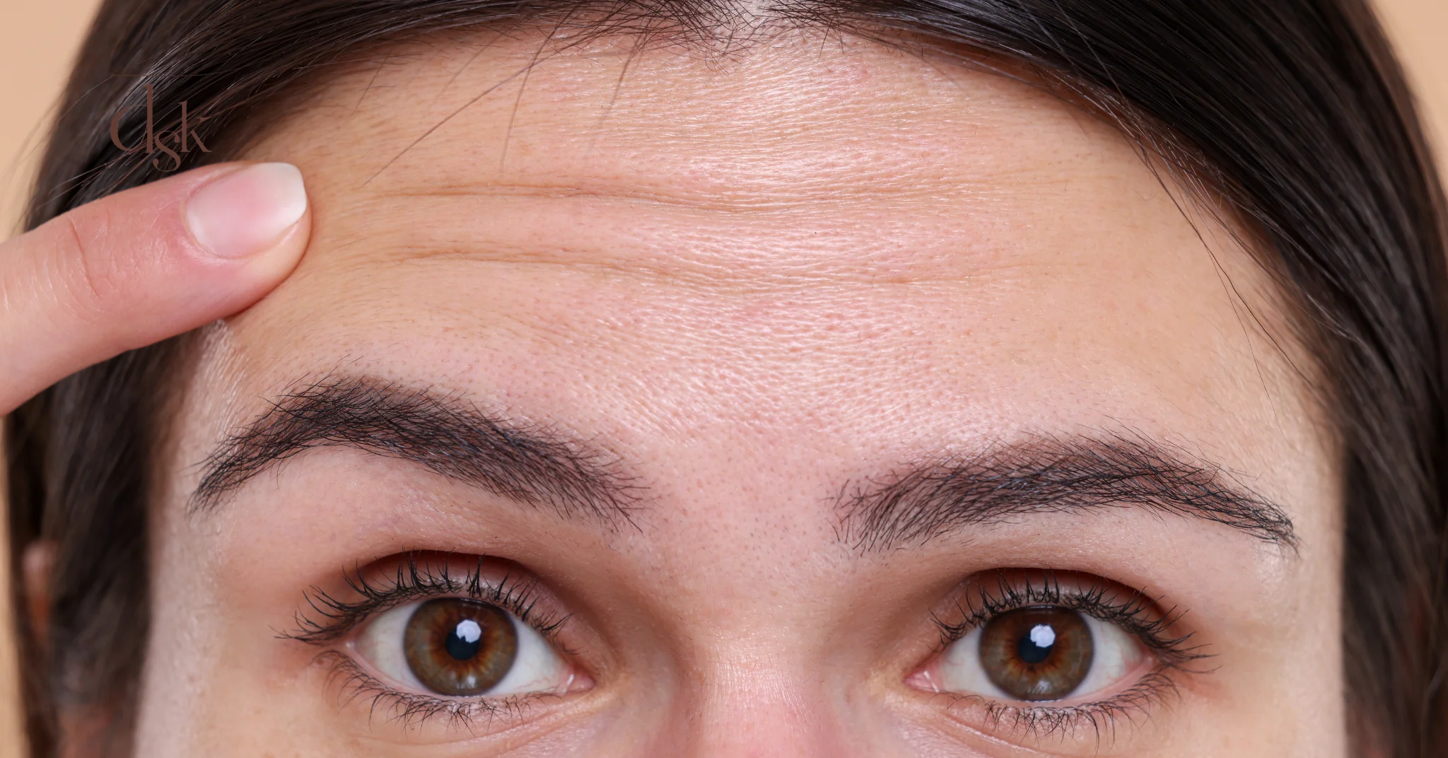 สาเหตุของการเกิดริ้วรอยหน้าผาก