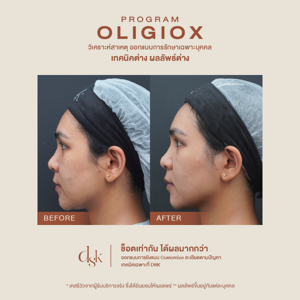 B_A oligioX 01 done (1)