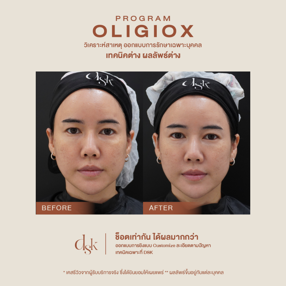 B_A oligioX 02 done (1)