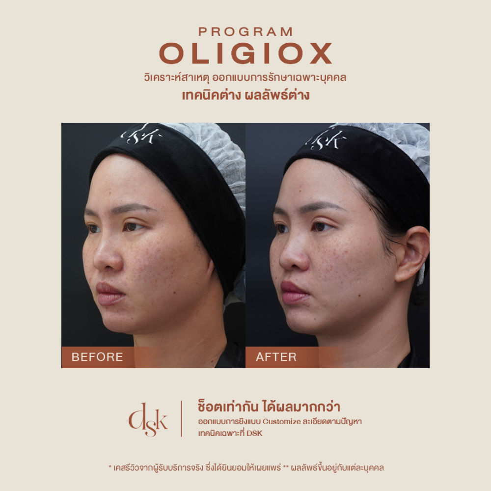 B_A oligioX 03 done (1)