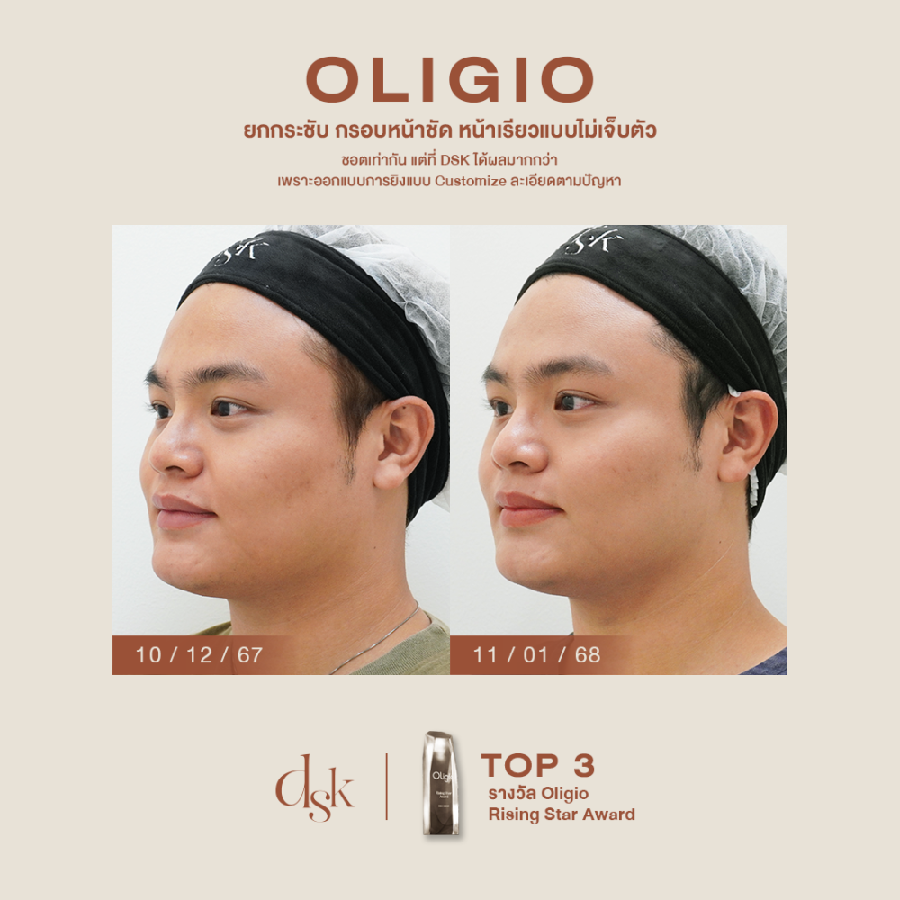 HN.P67-000287_Oligio_dr.kew