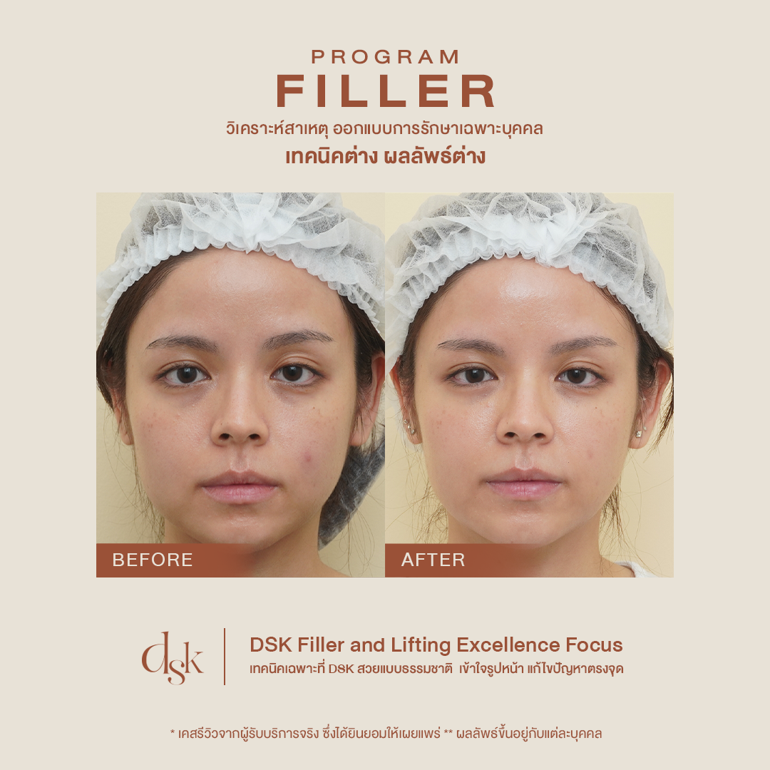 Program Filler - DSK Clinic I The First Customized Clinic