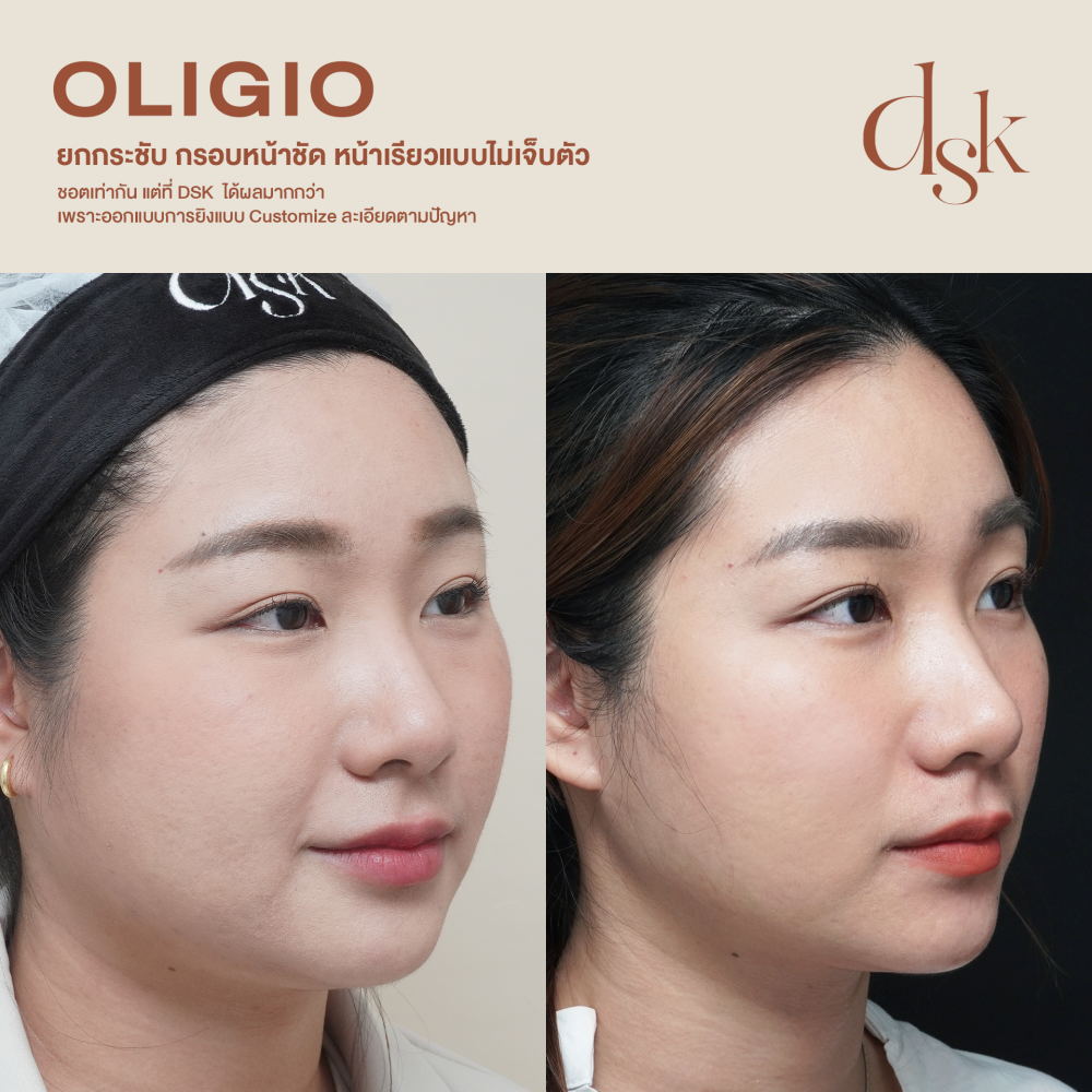 HN.R65-016059_oligio