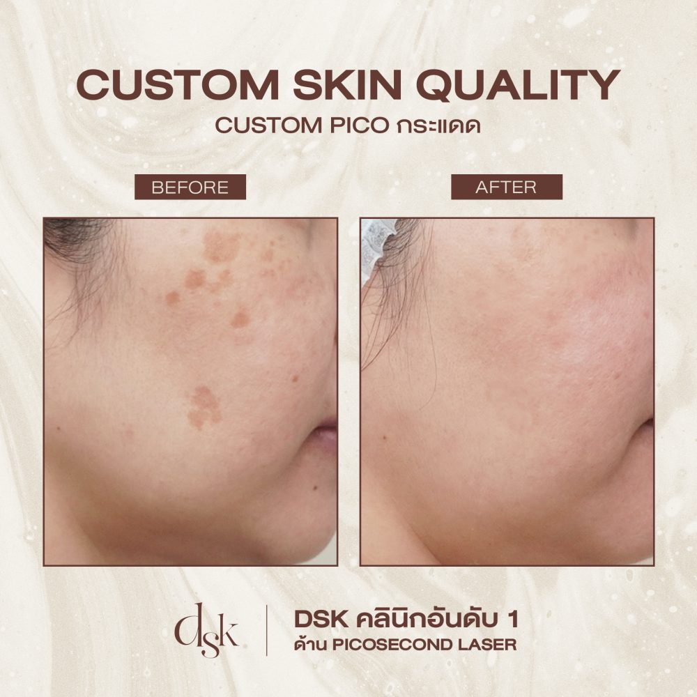 HN.R66-017647_Pico กระแดด