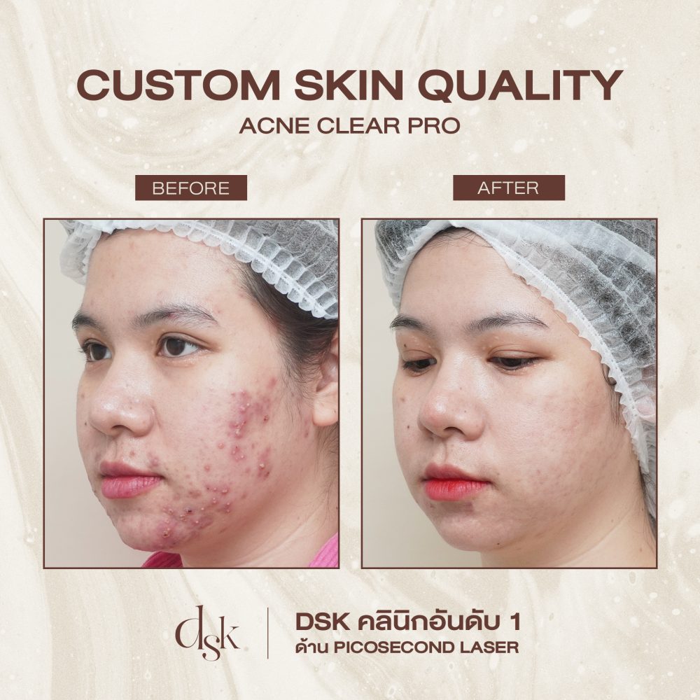 HN.R66-017805_SKIN QUALITY