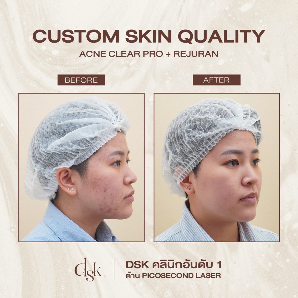 HN.S65-000116_SKIN QUALITY