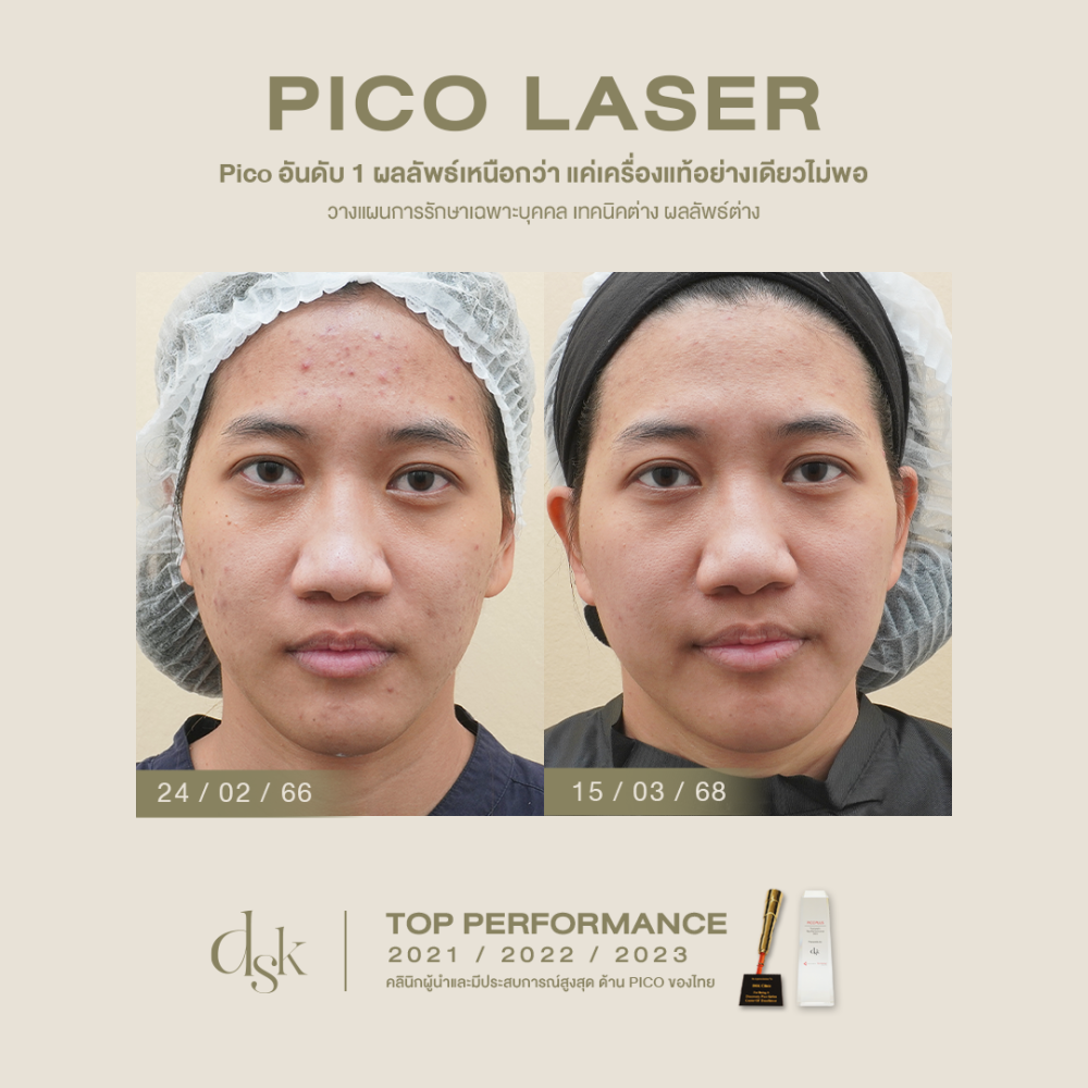 HN.S66-000446_custompicopro