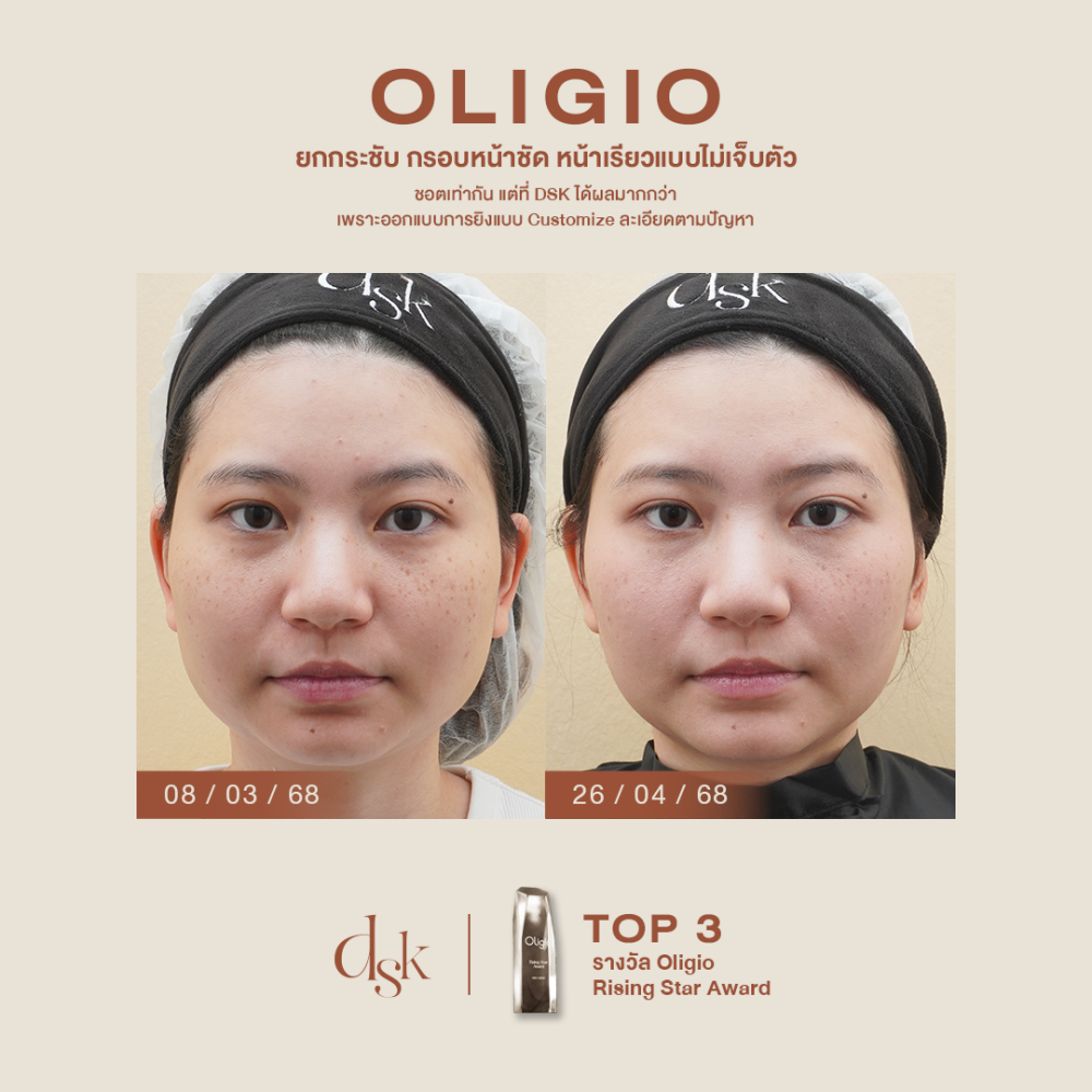 HN.S68-002637_Oligio_dr.price