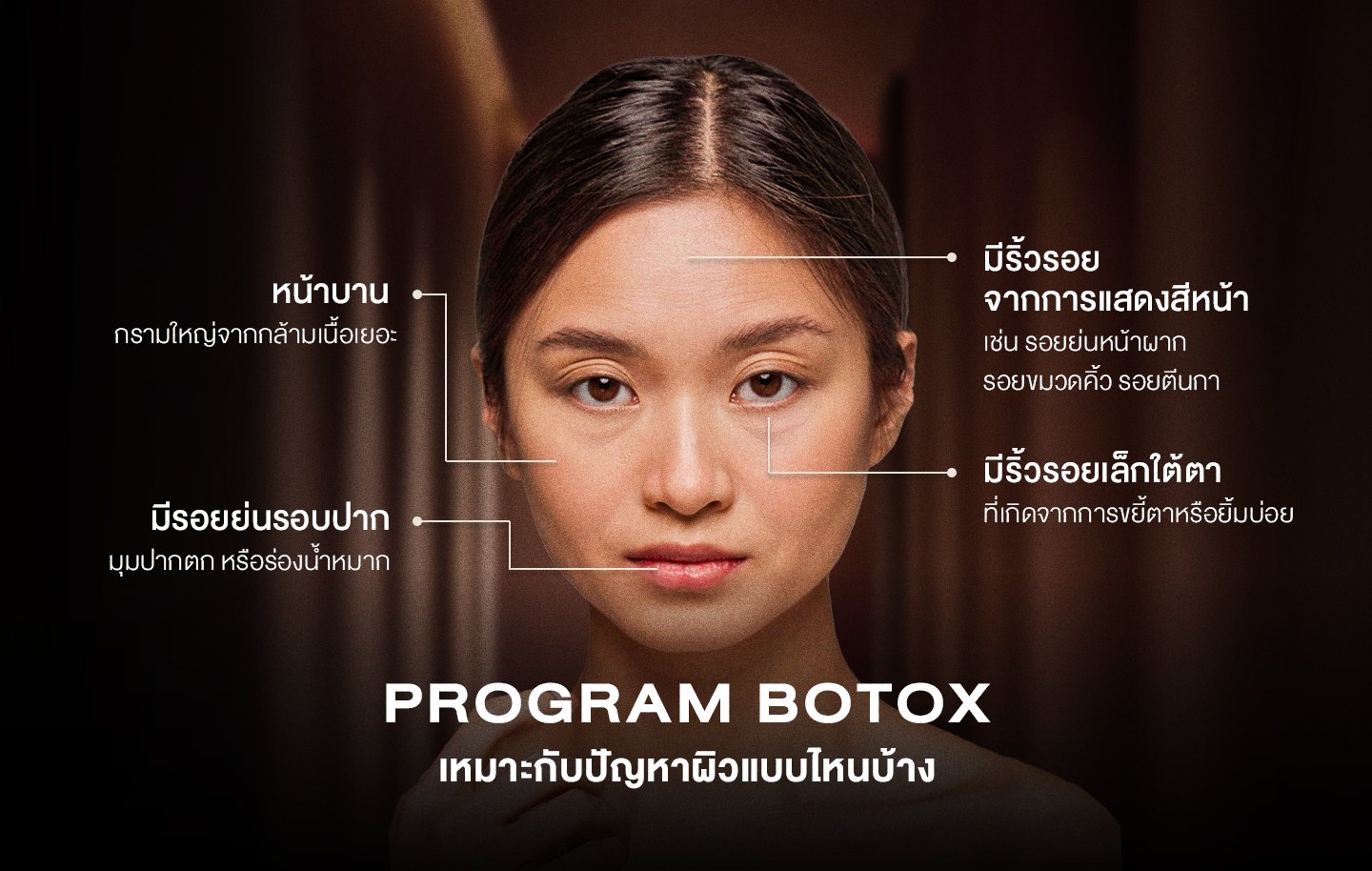 Program Botox - DSK Clinic I The Customized Clinic