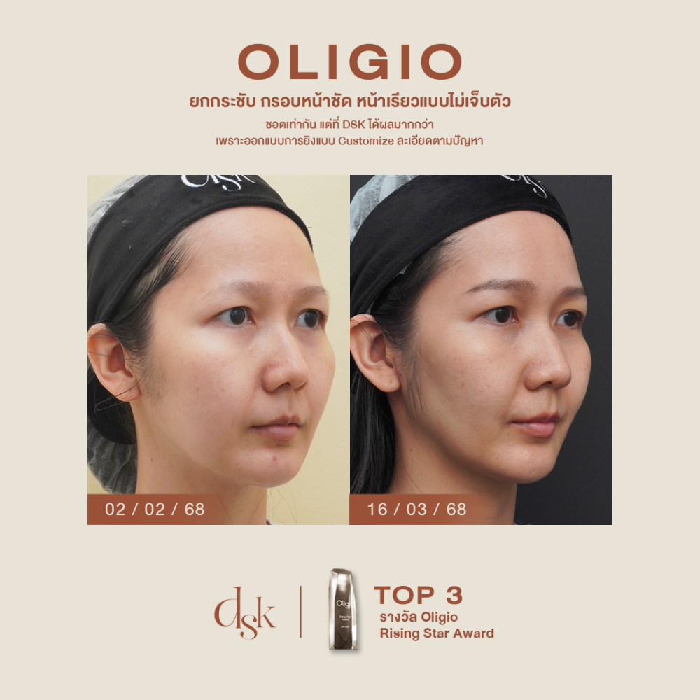 hn.B68-001745_oligio_dr.gift